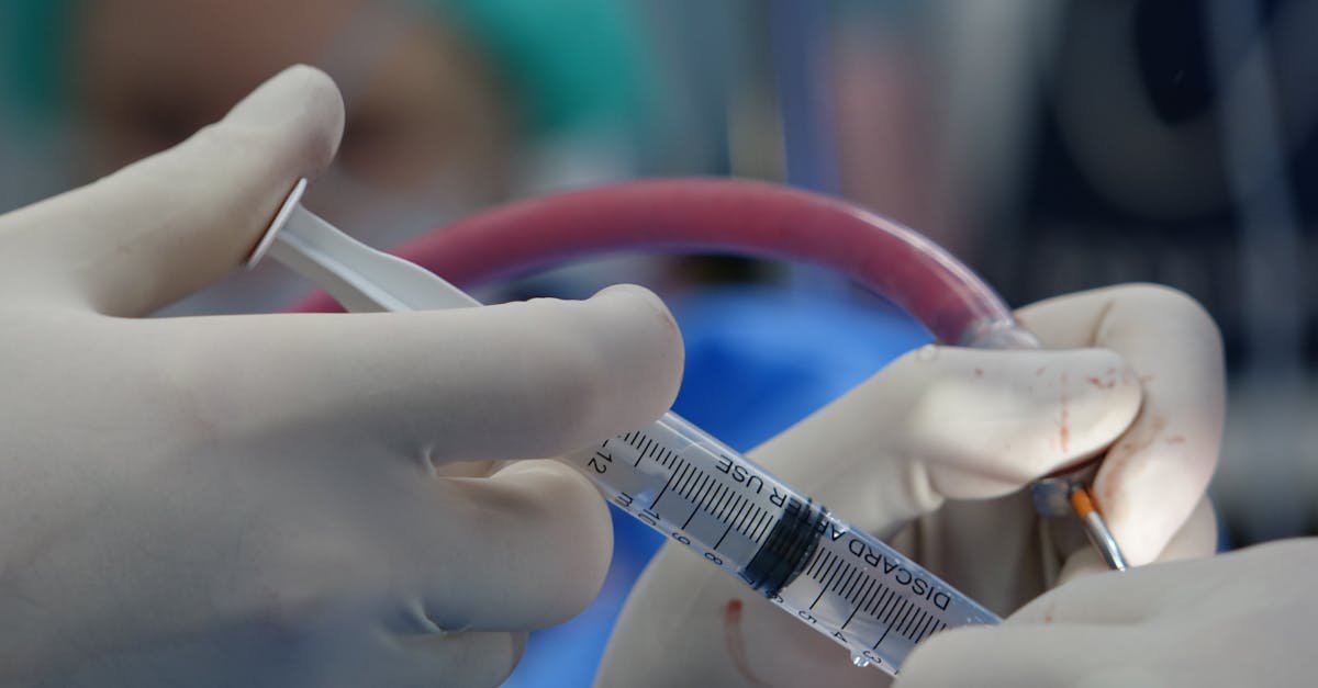 Poród bez strachu? Znieczulenie zewnątrzoponowe – korzyści, ryzyka i fakty, które warto znać